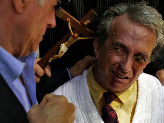 a man with black eyes and another man threatening him with a closed fist.